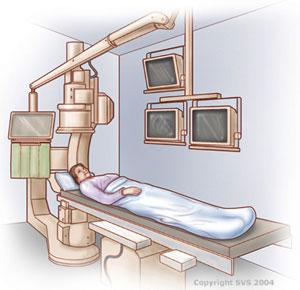 A patient receiving an angiogram