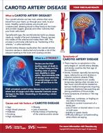 thumbnail of carotid flier