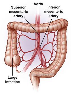 A layout of the large intestine with arrows to the superior mesenteric artery, aorta and the inferior mesenteric artery