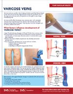 thumbnail of varicose veins flier