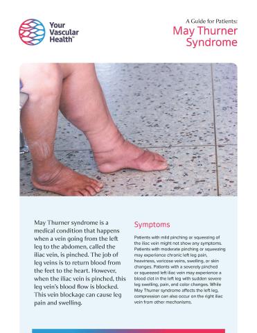 May Thurner Syndrome Flyer Image