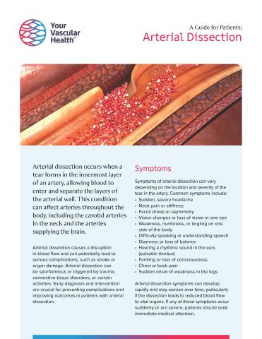 Arterial Dissection Image of Flyer