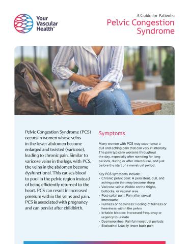 Pelvic Congestion Syndrome Image of Flyer