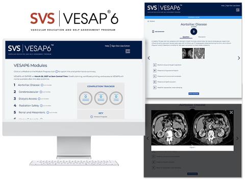 Image of a computer showcasing the VESAP6 modules.