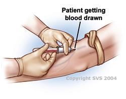 A patient arm is depicted getting blood drawn. 